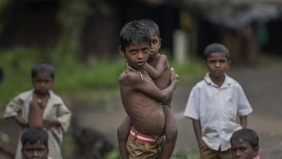 Children suffering from malnutrition (HT FILE)